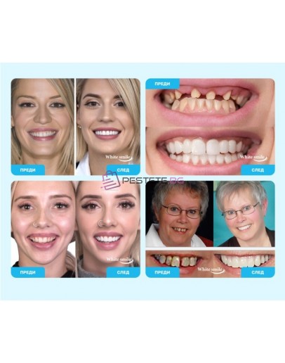 Декоративни изкуствени зъби Snap on Smile